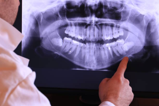 Best Cosmetic Emergency Dentistry in Ottumwa, IA